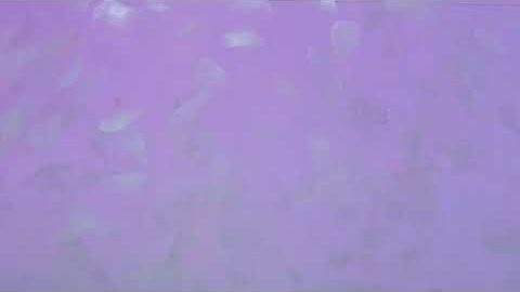_